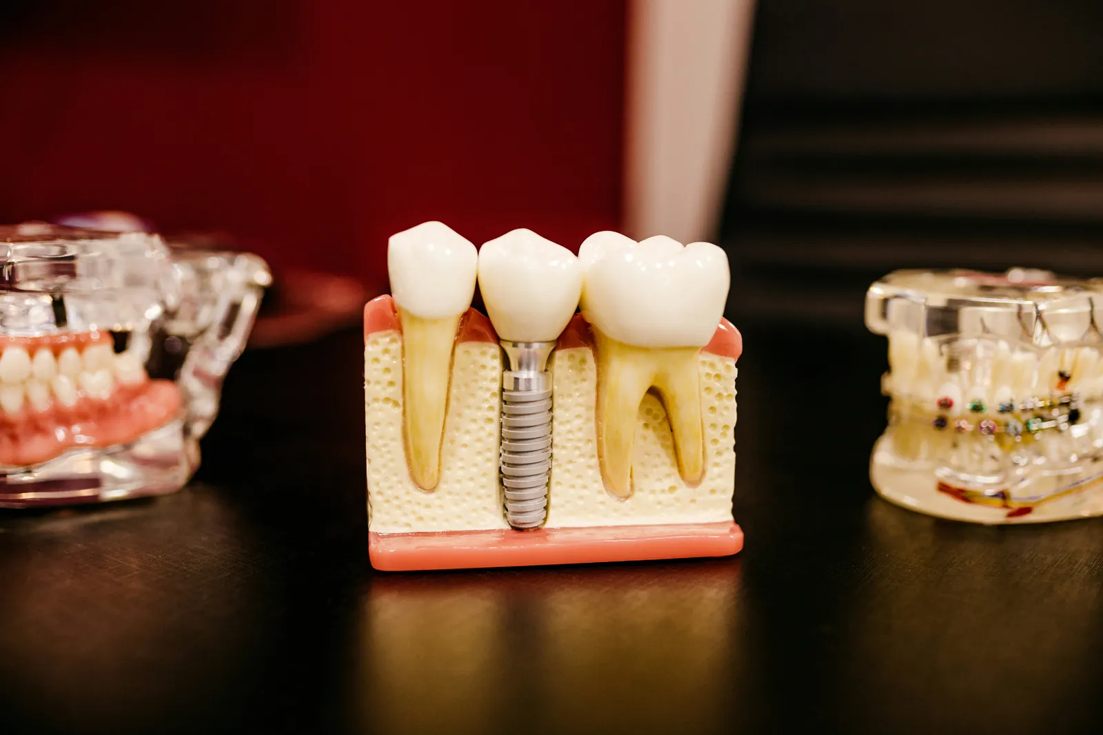 Root Canal in Long Island, NY
